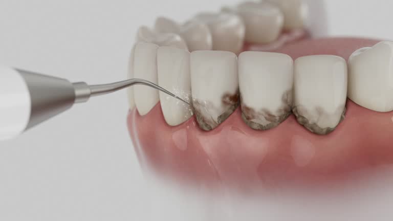Trusted Dental Implants service in Lamoni, IA - Dentist Open Now